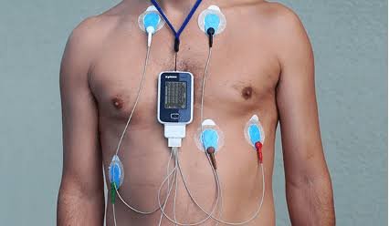 Equipo de Holter de electrocardiograma de 24 horas